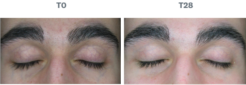 Resultados del test clínico realizado con el Refreshing Eye Cream